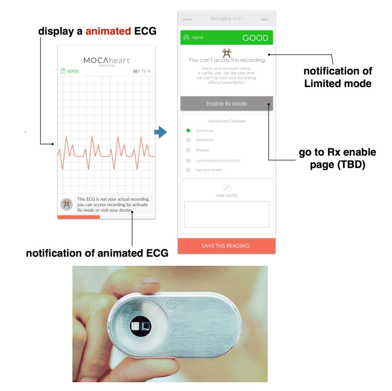 MOCACare medical version